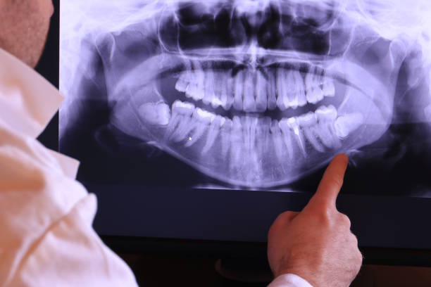 Best Tooth Pain Emergency Relief  in Meridian, TX